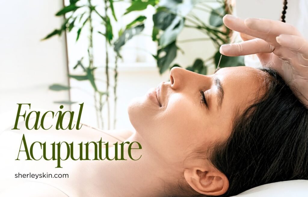 facial rejuvenation acupuncture