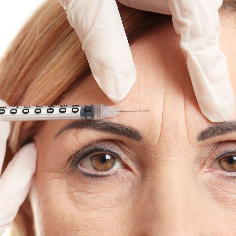 facial rejuvenation